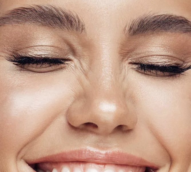 Entstehung von Bunny Lines durch wiederholtes Zusammenziehen der Nasenmuskulatur