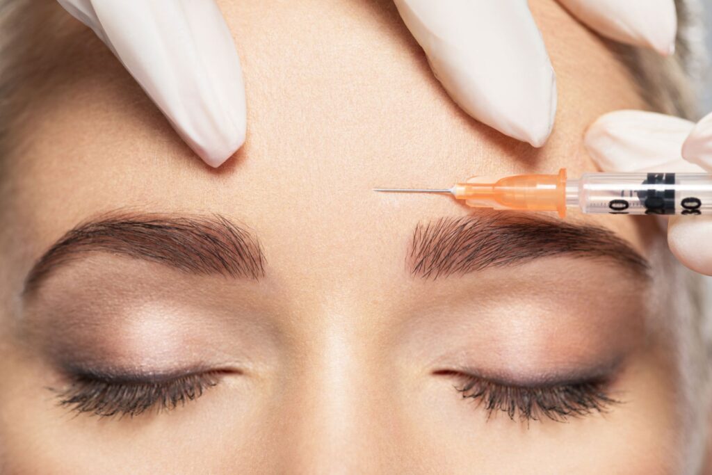 Botox Zornesfalte - Dr Schuhmann Zürich