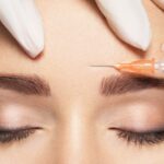 Botox gegen Migräne – Linderung bei chronischen Kopfschmerzen