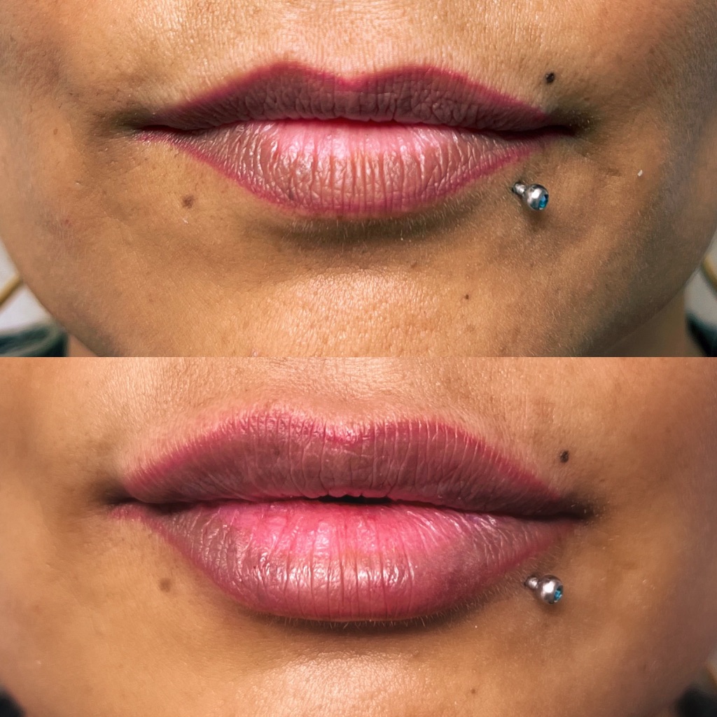 Lips 1