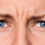 Zornesfalte loswerden mit Botox, Filler oder gar beidem?