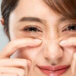 Bunny Lines Ursachen – feine Fältchen an der Nase verstehen