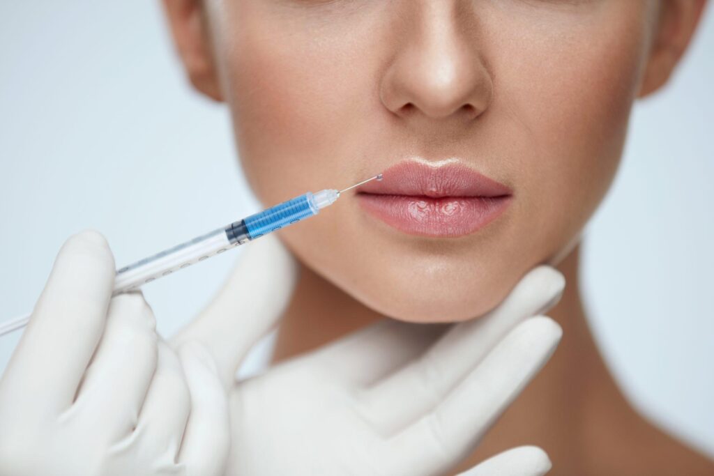 Lippen aufspritzen in Zürich bei ConceptYOU