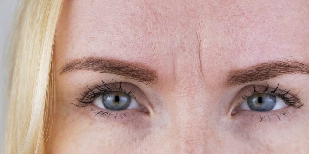 Nahaufnahme einer blonden Frau mit ausgeprägten Stirnfalten