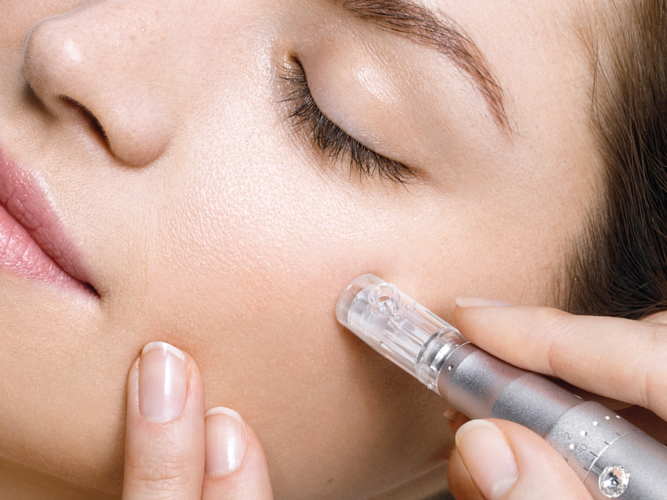 Microneedling-Behandlung im Gesicht mit Dermapen zur natürlichen Hautregeneration und Verbesserung der Hautstruktur